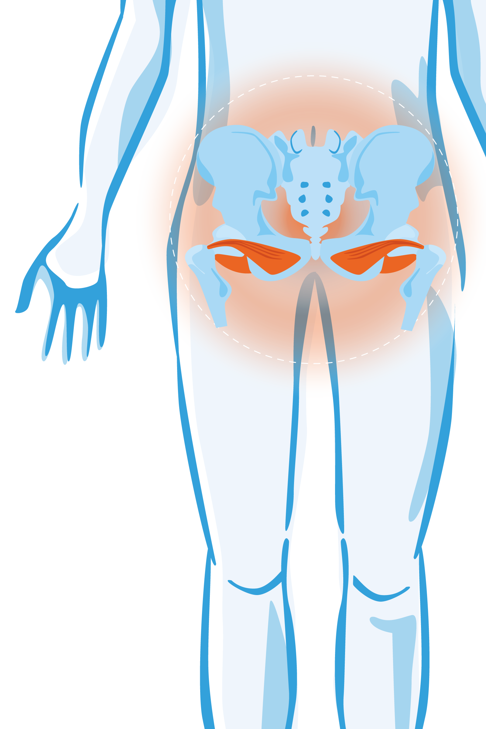 Pijn onder in buik of bekken