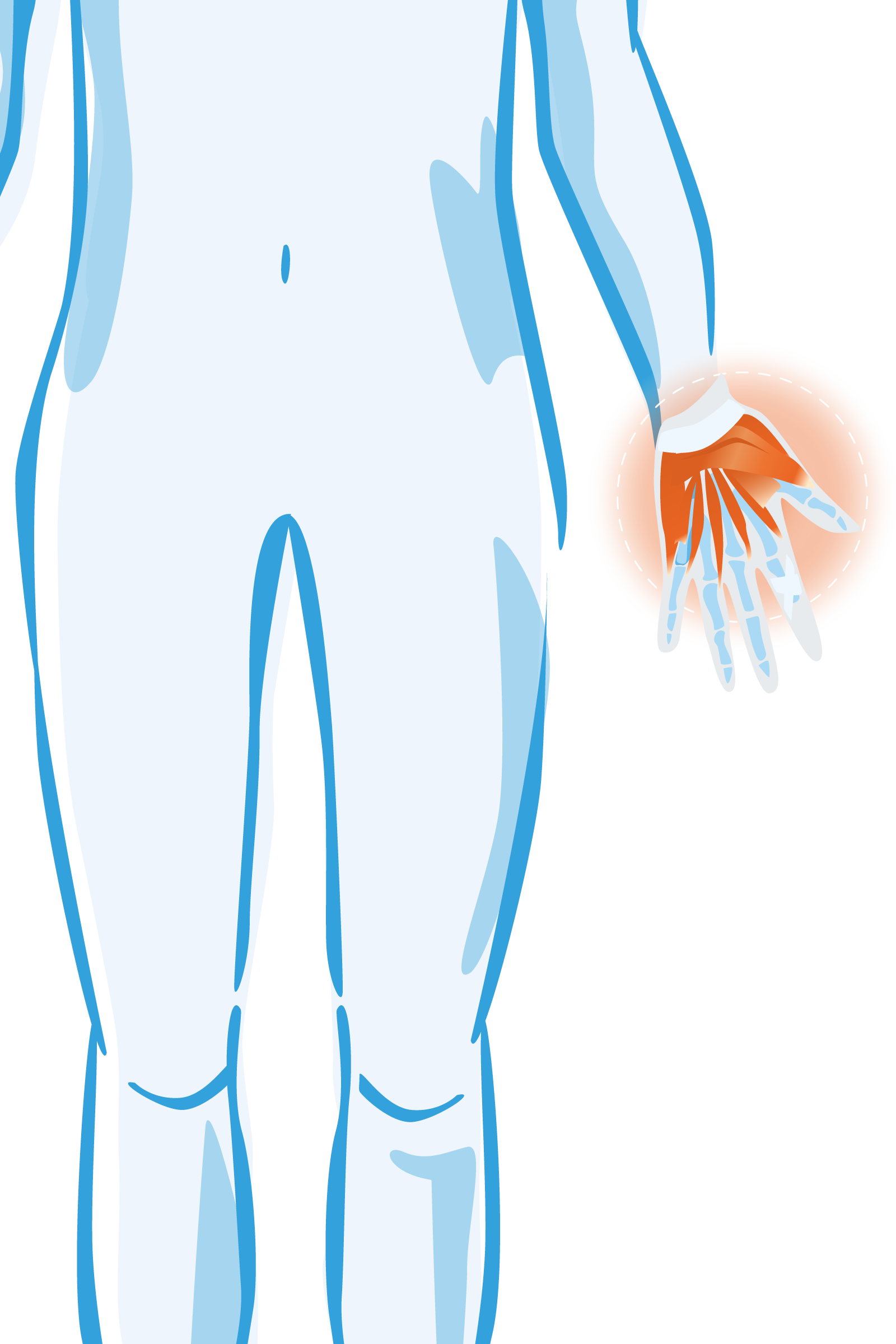 Pols- en handklachten