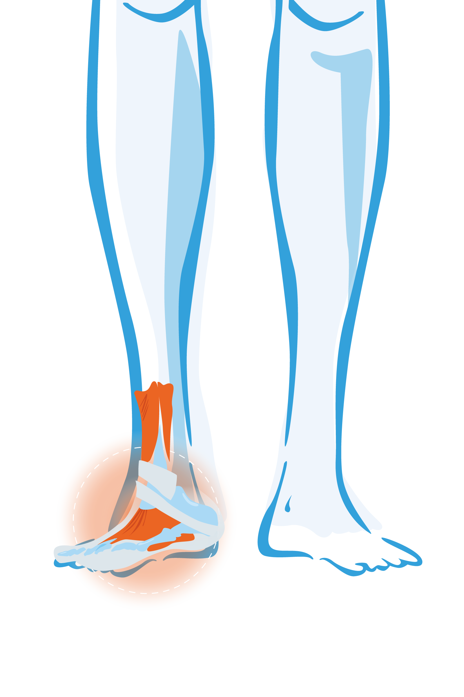 Enkel- en voetklachten